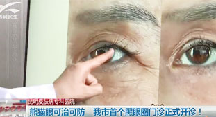 熊猫眼可治可防，我市黑眼圈门诊正式开诊!